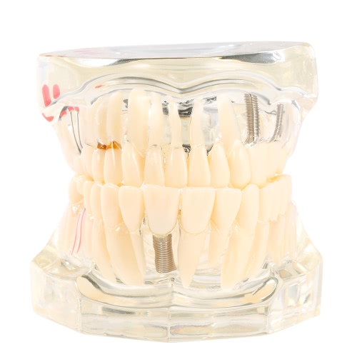 Прозрачная зубоврачебная зубоврачебная зубоврачебная модель зубов Модель зубоврачебного зубоврачебного взрослого Typodont съемная модель зубов